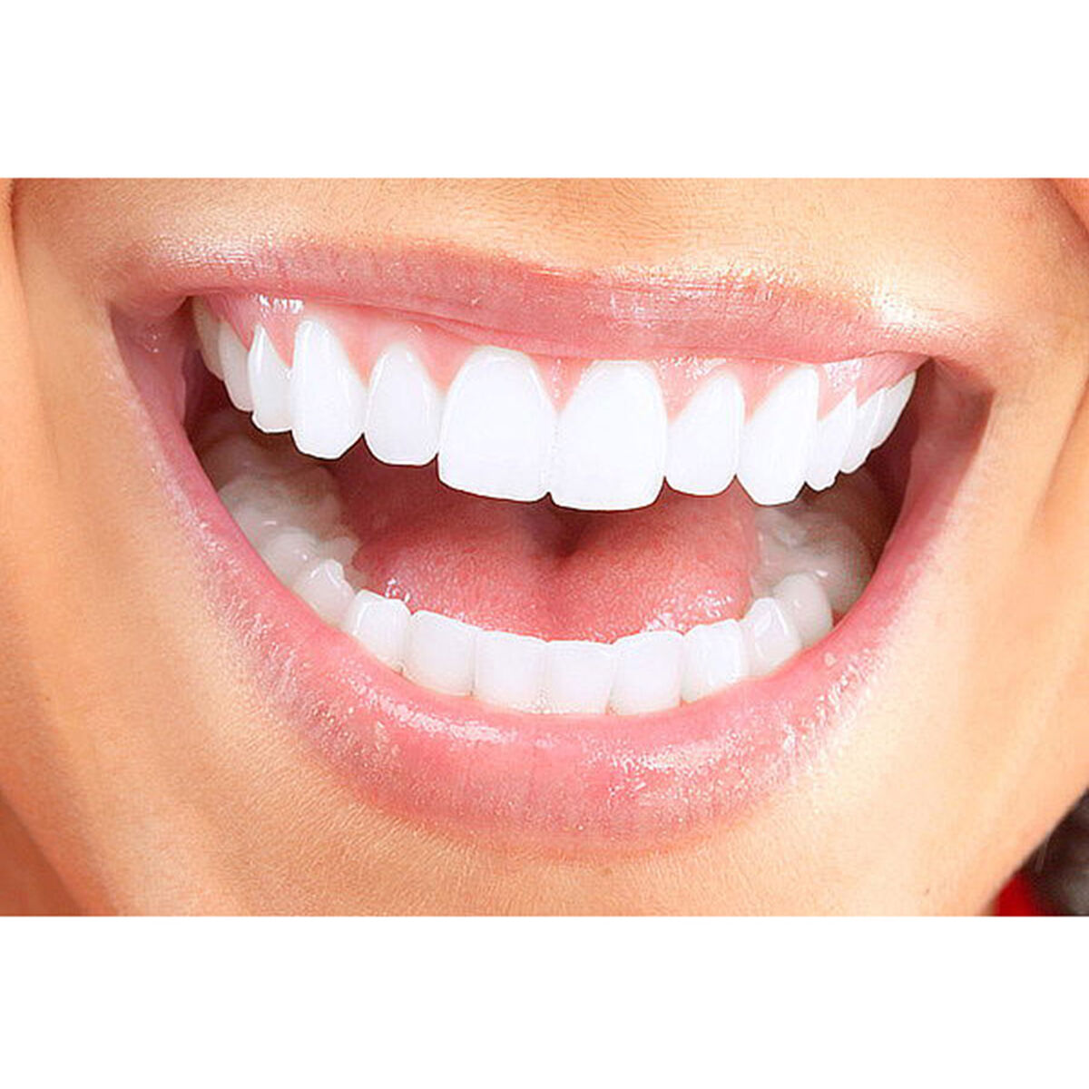 Limpieza dental + blanqueamiento en Clínica Odontológica Dentointegral, Providencia